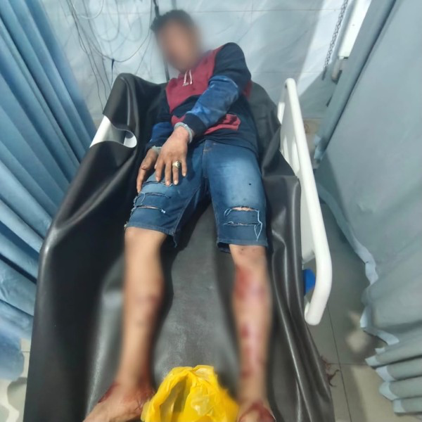 Serang Polisi dengan Sajam Saat Penggerebekan, Terduga Pengedar Pil Ekstasi di Pekanbaru Dilumpuhkan, 50 Butir Diamankan