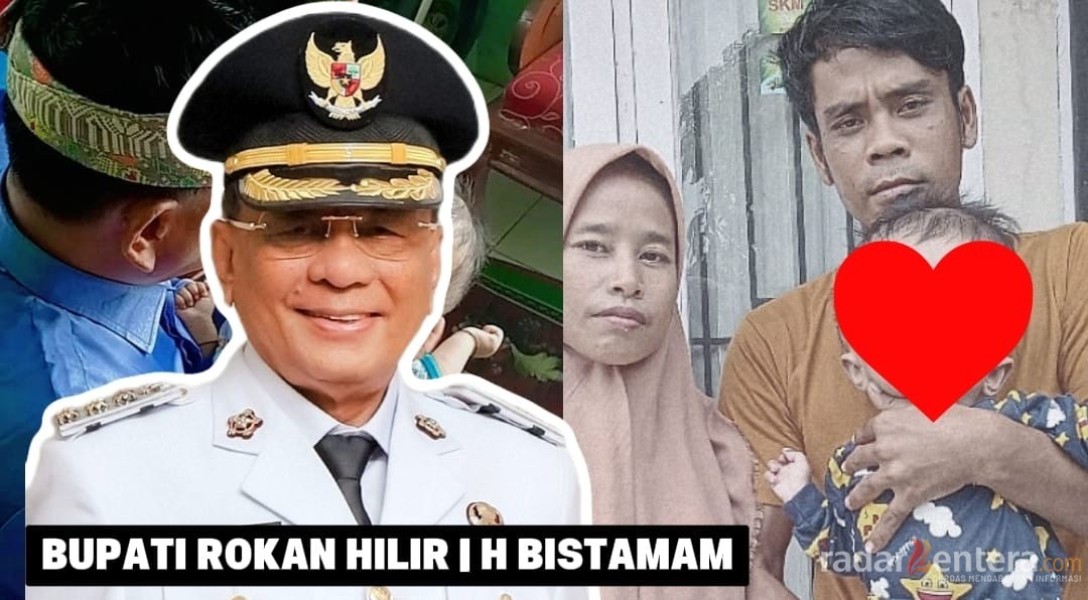 Bupati Rohil H Bistamam Beri Perhatian Penuh Kepada Anak Penderita Hidrosefalus di Bangko Pusako